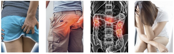 Hemokeys Cara Pemakaian - dosis dan etunjuk penggunaan